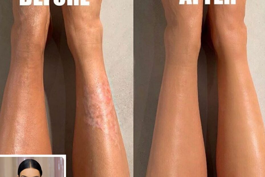 Kim Kardashian Covers Up Her Psoriasis Using New Kkw Beauty Body Makeup