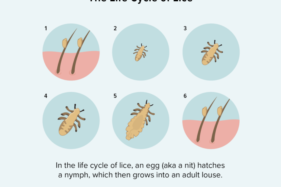 Finding Nits But No Lice In Your Hair: What To Do Next