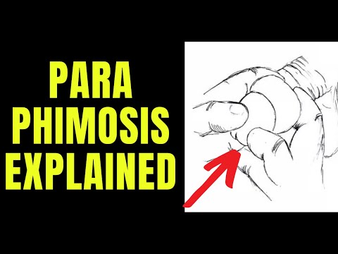 Doctor explains Paraphimosis - aka swollen foreskin that you can't pull back...