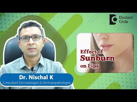Do We Get SUNBURN on Lips? How Dangerous Is It? #cancer #sunburn  - Dr. Nischal K | Doctors' Circle