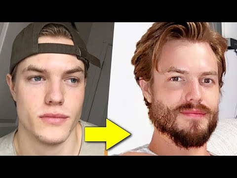 How to Grow a Beard From Nothing (FULL GUIDE)