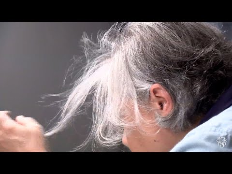 Mayo Clinic Minute: Expert advice for women with thinning hair