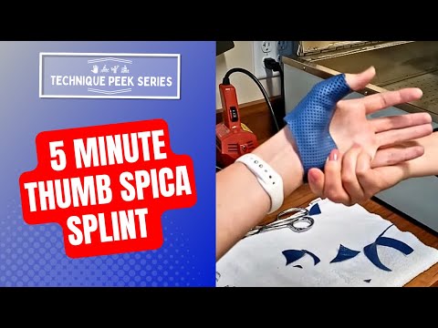 How to Make a Thumb Spica Splint in less than 5 Minutes  |  #TechniquePeekSeries