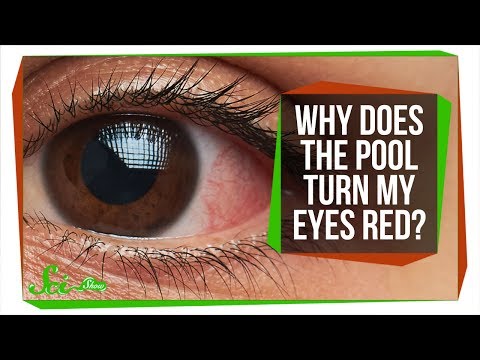 Why Do Your Eyes Get Red in the Pool?